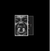 hw5ewQT.png